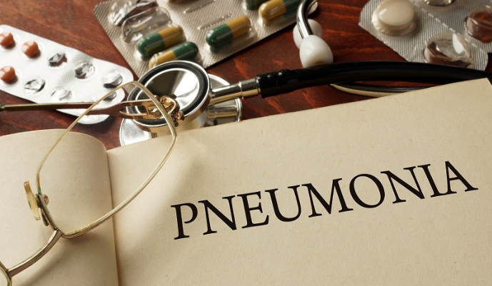 Pneumonia – A Severe Viral and Bacterial Disease