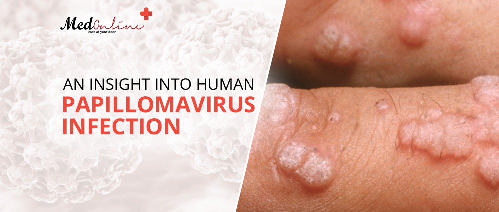 Human-Papillomavirus-Infection-blog