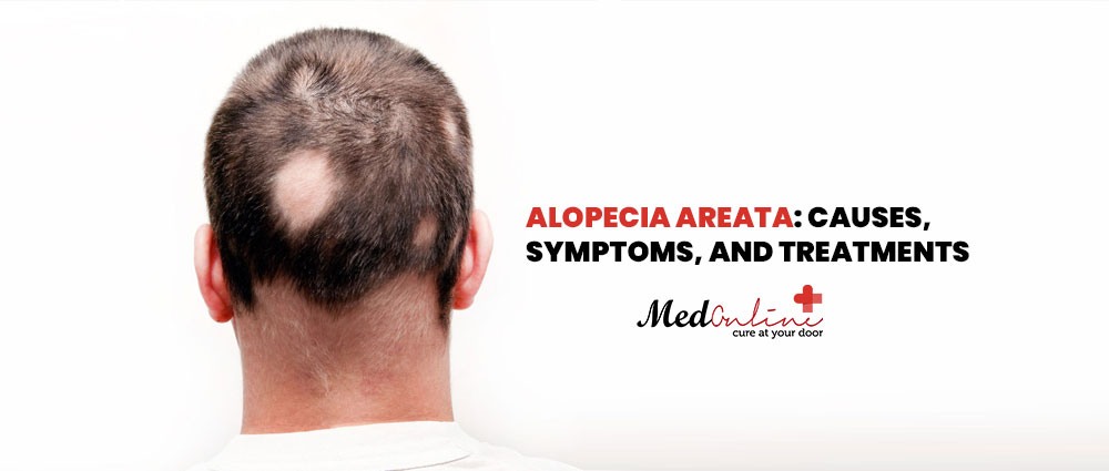 alopecia-areata-causes-symptoms-and-treatments